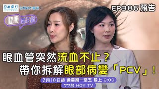 【日本命力呈獻: 健康關注組】｜ 眼血管突然流血不止？帶你拆解眼部病變 「PCV」!｜ EP386 預告 ｜ 醫學節目｜ 健康資訊 ｜HOY 77
