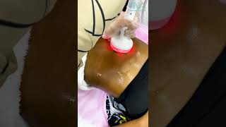 Slimming Treatment @rivalasermedicalcenter9622