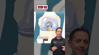 ACL Repair using the BEAR Technique 🪡  #Shorts