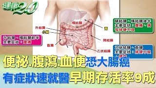 便祕.腹瀉.血便恐大腸癌 有症狀速就醫早期存活率9成 健康2.0