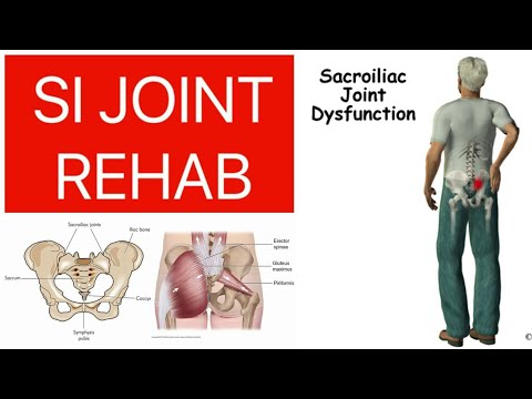 Treatment of SI Joint Pain, Sacroilitis, Exercises for Sacroiliac Joint Pain, SI JOINT PAIN Part-1