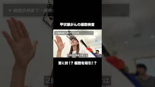 【甲状腺がん】細胞検査で一番怖かったのはアレ！ #甲状腺乳頭癌 #がんサバイバー #リアル闘病記 #体験談