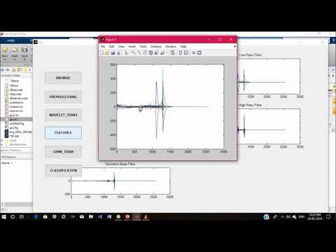 ANALYSIS AND REMOVAL OF EEG-ECG ARTEFACTS USING ANN CLASSIFIER