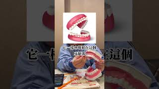 假牙照顧不周 說掉就掉QQ 粉絲們一定要好好刷牙預防牙周病  #林口牙科 #林口牙醫 #邱耀賢醫師