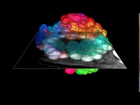 3D reconstruction of a honeybee antennal lobe
