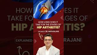 How Long Do Stages of Hip Arthritis Progress AFTER COVID-19? - Dr. Amyn Rajani Explains