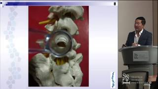 Why MIS Surgery? Tips & Pitfalls  - Jeffrey S.  Roh, MD, MBA