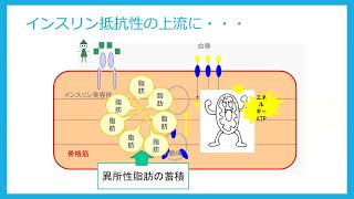 糖尿病予防に向けた講演会今スグ実践、動いて予防！糖尿病（佐藤真治先生講演動画）