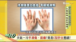 手腳冰冷是警訊！恐是心血管疾病前兆！ 健康2.0