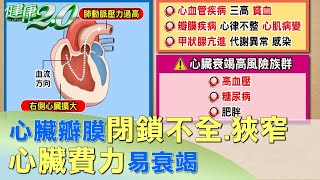 心臟4個瓣膜！閉鎖不全.狹窄 心臟費力易衰竭 健康2.0