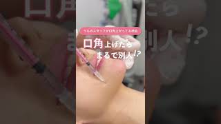口角って大事💁🏻‍♀️👏🏻#美容 #美容治療 #湘南美容クリニック #垢抜け #ボトックス #口角 #若返り美容 #シワ改善 #口元美容 #botox #sbc #shorts