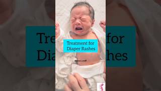 Best Treatment for Diaper Rash #diaperrash #babyrash
