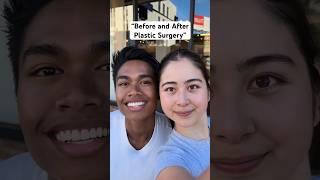 Whose transformation is better? 🤭@_angelo #sofimanassyan #friends #transformation