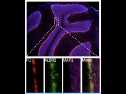 Molecular Imaging Quantification of Neurochemicals in Cell-type Specific Alcohol Metabolism