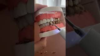 Boost your smile: essential teeth care tips #yoyo #teethcare