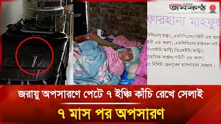 জরায়ু অপসারণে পে/টে ৭ ইঞ্চি কাঁ/চি রেখে সে/লা/ই, ৭ মাস পর অপসারণ | Janakantha