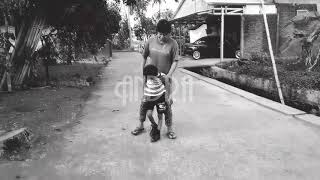 Fisioterapi anak cerebral palsy "Latihan Berjalan menggunakan sepatu AFO"
