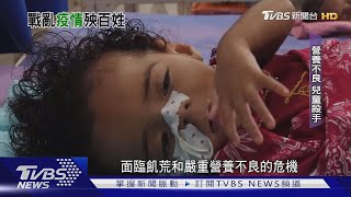 【十點不一樣】內戰飢荒與疫情 葉門民眾活在危險邊緣