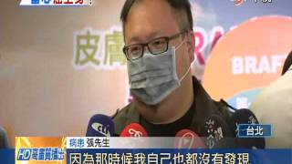 【中視新聞】愛運動曬太陽 台灣皮膚癌患者增 20140609