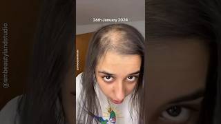 🔥30 Days Hair Growth Challenge 😱 | Hair Growth Tips ✅ #shorts #youtubeshorts Smbeautylandstudio