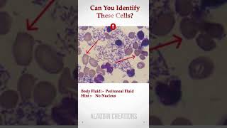 Can you identify these Cells In Body Fluid ? 🧐🙄🤔 #Quiz 403