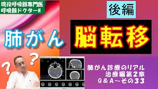 肺がんの脳転移（後編）：治療
