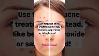 Treat Acne With Toothpaste? #AcneCare #HealthySkin #NoMoreToothpaste