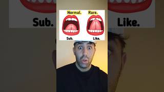 Normal Or Rare? #shorts #thoughts #foryoupage #xyzbca #viral
