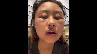 看小姐姐真實記錄植髮七天，這不仔細看，根本看不出來植髮了 WhatsApp：+86 15321677132  WeChat：bbls616