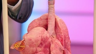 Most-Googled Questions: Is Bronchitis Contagious?