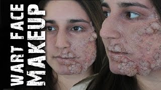 Wart Foam latex Prosthetic Application