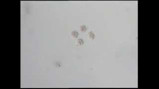 Embryo Transfer - IVF Training India