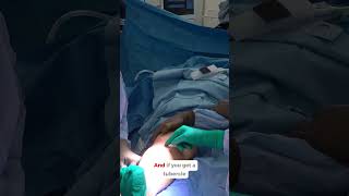 Right Distal Tibial Oblique Fracture Open Reduction and Internal Fixation (ORIF) #doctor #medical
