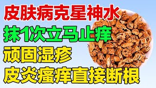 皮炎湿疹别乱抹药！这瓶皮肤病克星神水，抹1次立马止痒，不管是十年顽固湿疹还是烂皮皮炎，全给直接断根【养生有道】