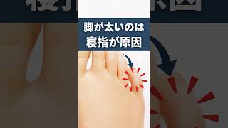 脚が太くなる原因の寝指を矯正する方法！外ももやふくらはぎ太りの改善に！