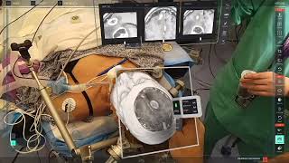 Medivis SurgicalAR in the OR