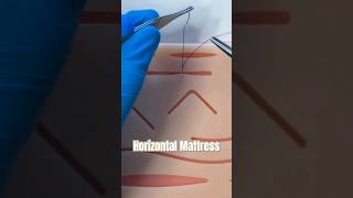 The Horizontal Mattress Suture #suturing #sutures #horizontalmattress #stitch #wound #urgentcare