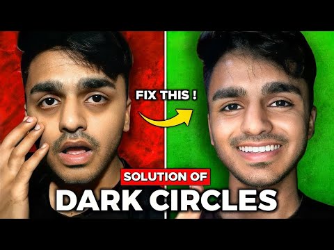 Dark Circles Permanent Solution (Hindi)