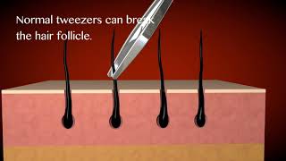 Why Regine Tweezers Stand Out From The Rest! The World’s Best Tweezers • Diamond Slant Tip Tweezer