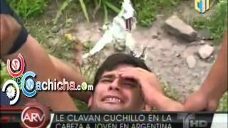 Camara Capta Cuando Le Claban Un Cuchillo En La Cabeza y Queda Vivo