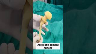 This saves infected hip replacements-Antibiotic cement spacer!! #shorts #revisionjointreplacement