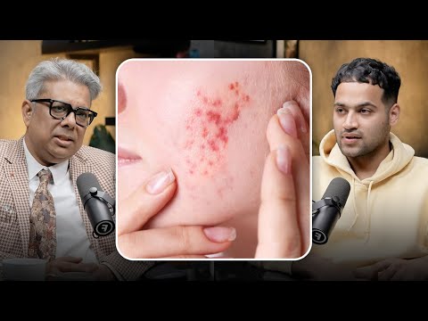 The Link Between Stress and Acne – Especially in Teens | Raj Shamani