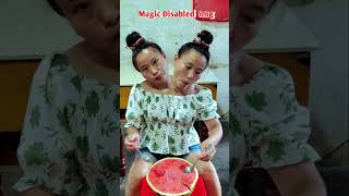 Tasbih song | conjoined twins sister omg | new tiktok video#godblessyou#shorts#viralshorts#newtiktok
