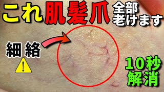 【放置厳禁】血行不良のサイン！細絡の原因と対策をお伝えします 肌 髪 爪の老化 疲労 手足のしびれ 食欲不振 全身の不調