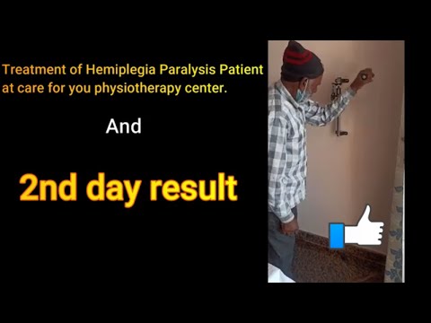 Treatment of Hemiplegia Paralysis Patient ( AFTER 2 DAYS TREATMENT RESULT)