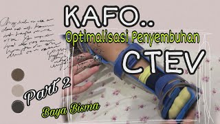 5 Hal Yang Perlu Diketahui Mengenai Sepatu CTEV : KAFO (Knee Ankle Foot Orthosis)
