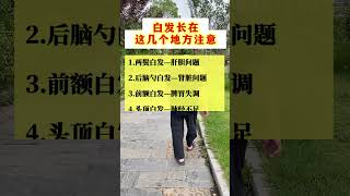 白发比较多的位置，是身体在提醒你要重视了#头发   #中医科普 #知识分享官