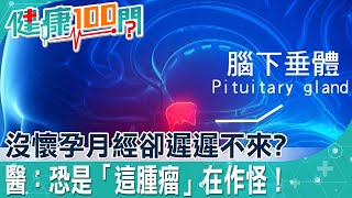 【健康100問】明明沒有懷孕月經卻一直不來是生病了嗎？醫提醒小心是「腦下垂體瘤」導致！ @中天電視CtiTv @健康我加1CtiHealthyme