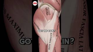 How To Fix Hip Pain (SCIATICA)
