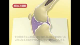 犬の骨関節炎「第2章」